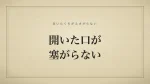 開いた口が塞がらない
